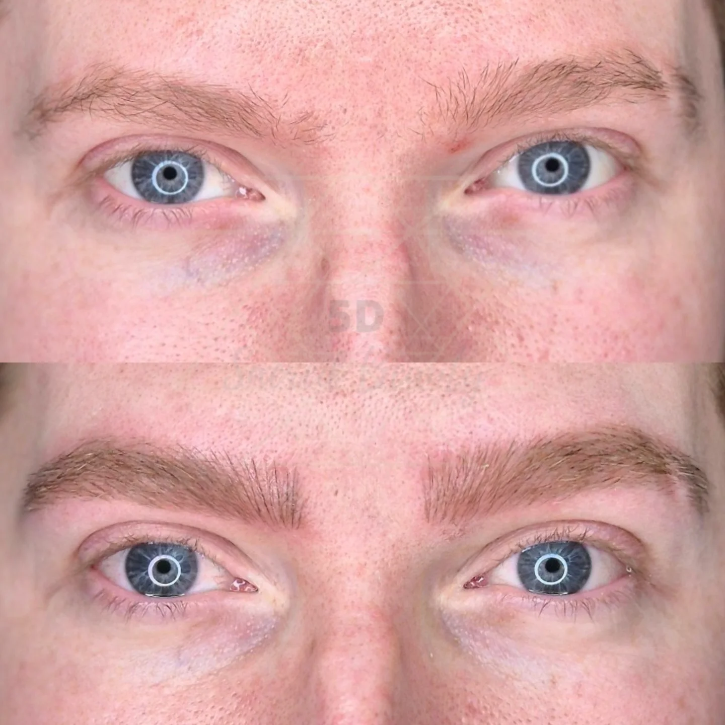 Resultado microblading Ibiza